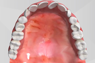 do 3d dental animation 3d orthodontic animation dental implant animation video