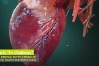 create 3d medical video 3d anatomy cellular biotech orthopedic pharma animation