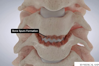 create 3d medical animation, 3d medical device animation, anatomy 3d animation