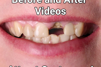 create a before and after video