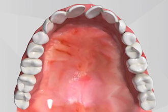 create realistic for 3d medical animation for dental explainer teeth procedures