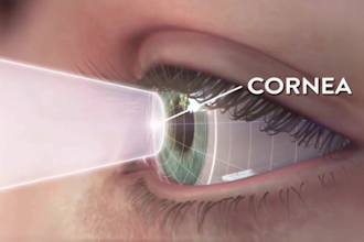 create realistic 3d eye animation, ophthalmology, and eye surgery videos
