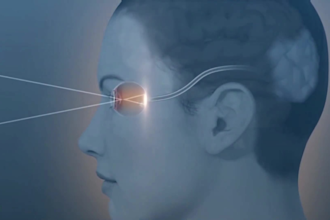 create 3d eye surgery animation, medical  modeling, and anatomy videos