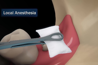 create 3d dental animation, 3d medical animation, realistic dental implant video