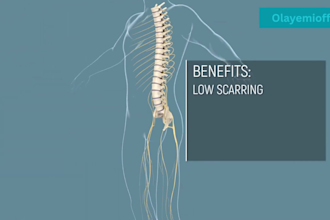 do 3d spine animation surgery animation biotech moa pharma scientific animation
