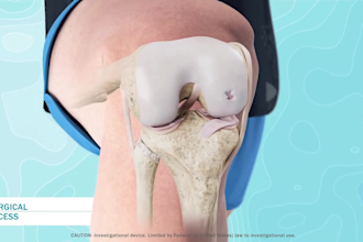 create 3d medical animation 3d medical device and orthopedic implant video