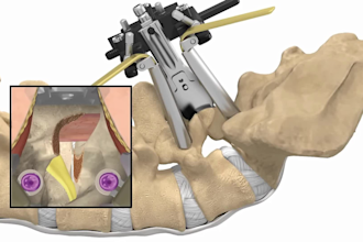do 3d medical animation spine surgery orthopedic implant joint explainer video