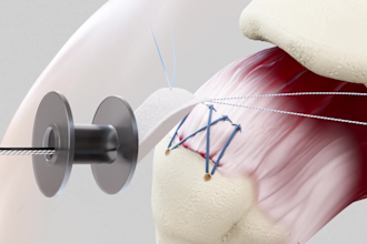 create medical device 3d surgery process explainer animation surgical simulation