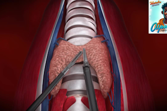 do 3d medical device animation 3d surgical device animation 3d medical explainer
