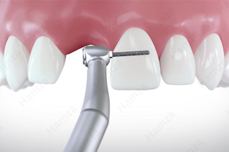 create professional 3d dental animation videos