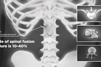 do 3d medical animation surgery animation 3d medical device 3d medical explainer