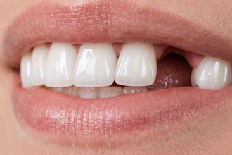 create 3d ai medical animation, 3d dental animation, healthcare explainer videos