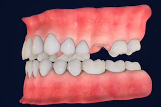 build realistic 3d medical animation for dental procedure, teeth explainer video