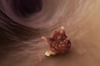 create realistic 3d medical animation, anatomy medical kidney animation surgery