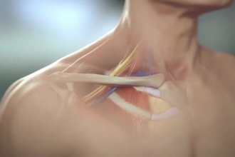 create professional 3d medical animation