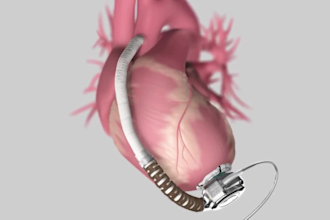 do 3d medical animation 3d medical device 3d surgery animation