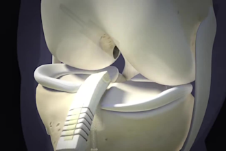 do 3d medical animation acl rehab knee surgery, anatomy explainer video 3d model