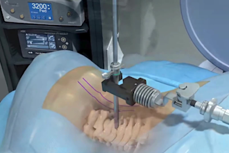 create professional 3d medical animation for orthopedic surgery and anatomy