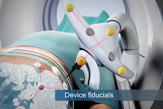 do 3d animation medical animation 3d medical animation explainer video medical