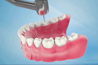 do 3d medical animation dental crown implant procedure biotech pharma animation