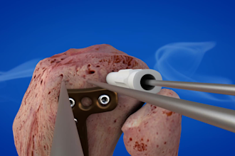 do 3d orthopedic spine anatomy animation 3d medical animation bone healthcare