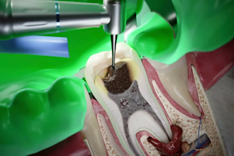 do 3d dental animation 3d orthodontic dental implant animation 3d medical video
