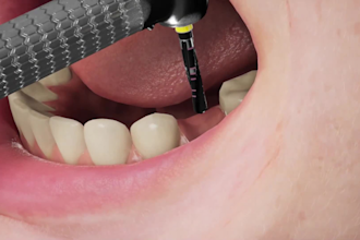 do 3d medical animation, dental animation, dental implant, 3d dental video