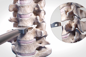create realistic 3d medical animation video