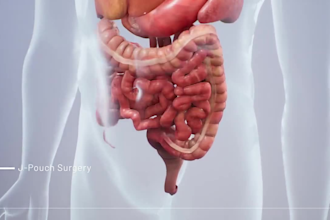 do 3d surgical animation video 3d anatomy explainer 3d medical animation video