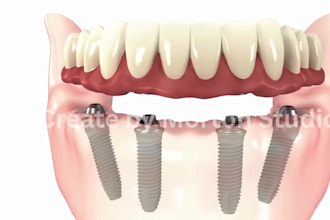 do 3d medical animation 3d orthodontic dental animation dental implant animation