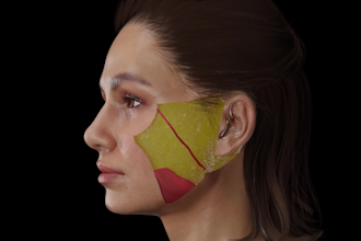 make 3d medical animation for a product or procedure