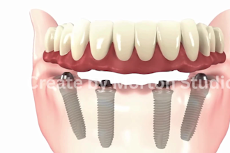 do 3d medical animation dental animation, implant, orthodontic, teeth anatomy