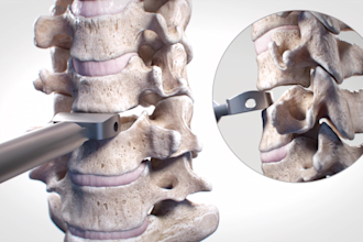 create professional 3d medical animation