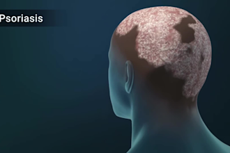 create 3d medical animation videos 3d surgery animation 3d medical anatomy