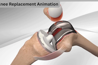 do 3d knee replacement total knee arthroplasty animation for your medical device