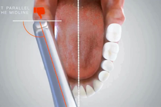 create 3d medical scientific video 3d medical animation surgery anatomy