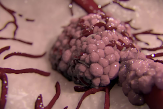 design realistic 3d medical animation oncology cancer pharmaceutical animation