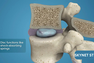 do 3d spine animation surgery animation biotech moa pharm scientific animation