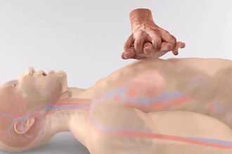 3d product, medical animation video, 3d medical animation, surgery 3d model cgi