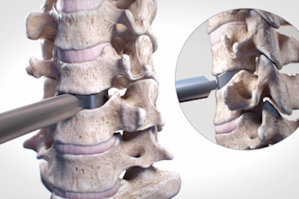 create realistic 3d medical animation video