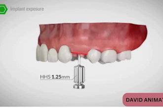 create  3d medical animation, 3d surgical, orthodontic dental animation video