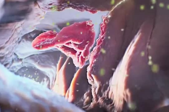 create high quality 3d medical animation video, surgery and scientific animation
