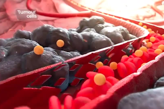 create 3d medical animation, 3d animation, 3d medical animated explainer video