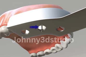 create 3d medical animation, dental implant and teeth surgery animation