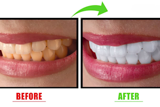 edit your teeth, align, whiten teeth, and remove braces in photoshop fast