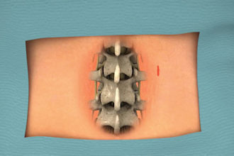 3d medical explainer animated video, 3d surgery animation, dental medical device