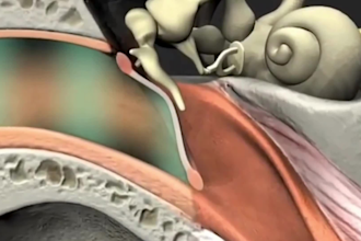 do 3d medical animation 3d medical video scientific medical animation explainer