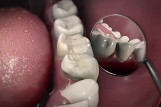do 3d medical animation, 3d medical video, anatomy animation, surgery animation