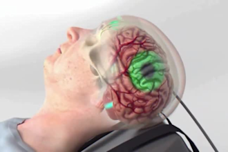 do 3d medical animation, 3d medical device,  industrial surgery animation