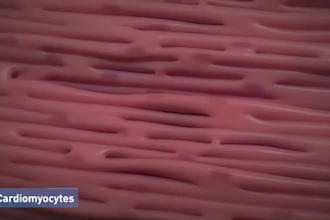 do 3d medical animation, surgery animation, 3d medical device, medical explainer